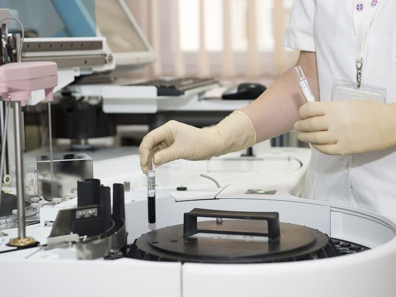 Програму "Безкоштовна діагностика" можуть відтермінувати