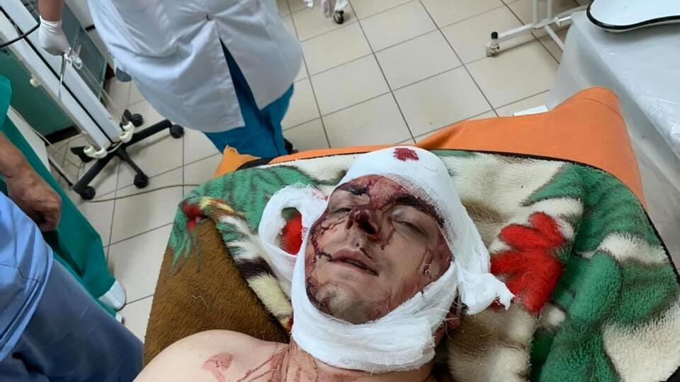 Правооохранители квалифицировали избиение по ч. 2 ст. 15 ч. 1 ст. 115 Уголовного кодекса