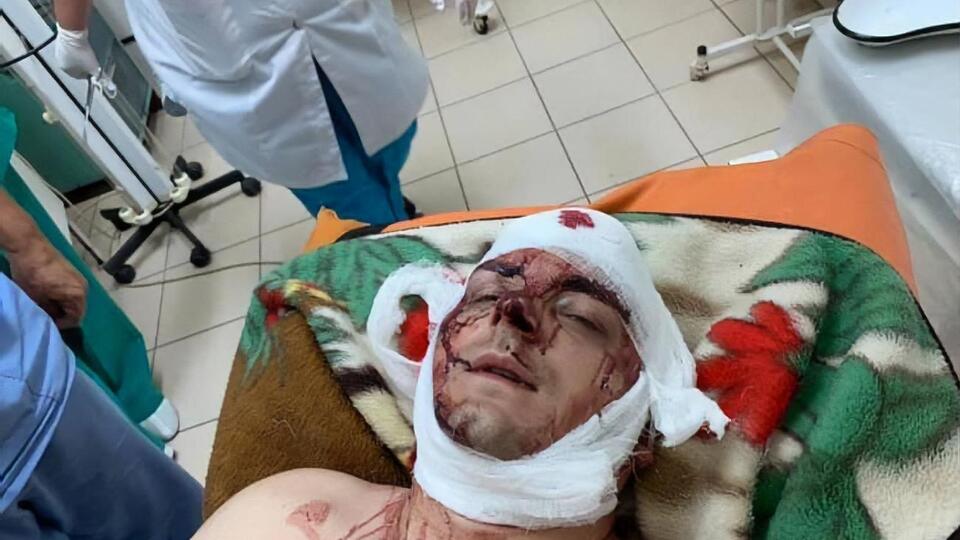 Семенихин был избит в ночь на 27 июня