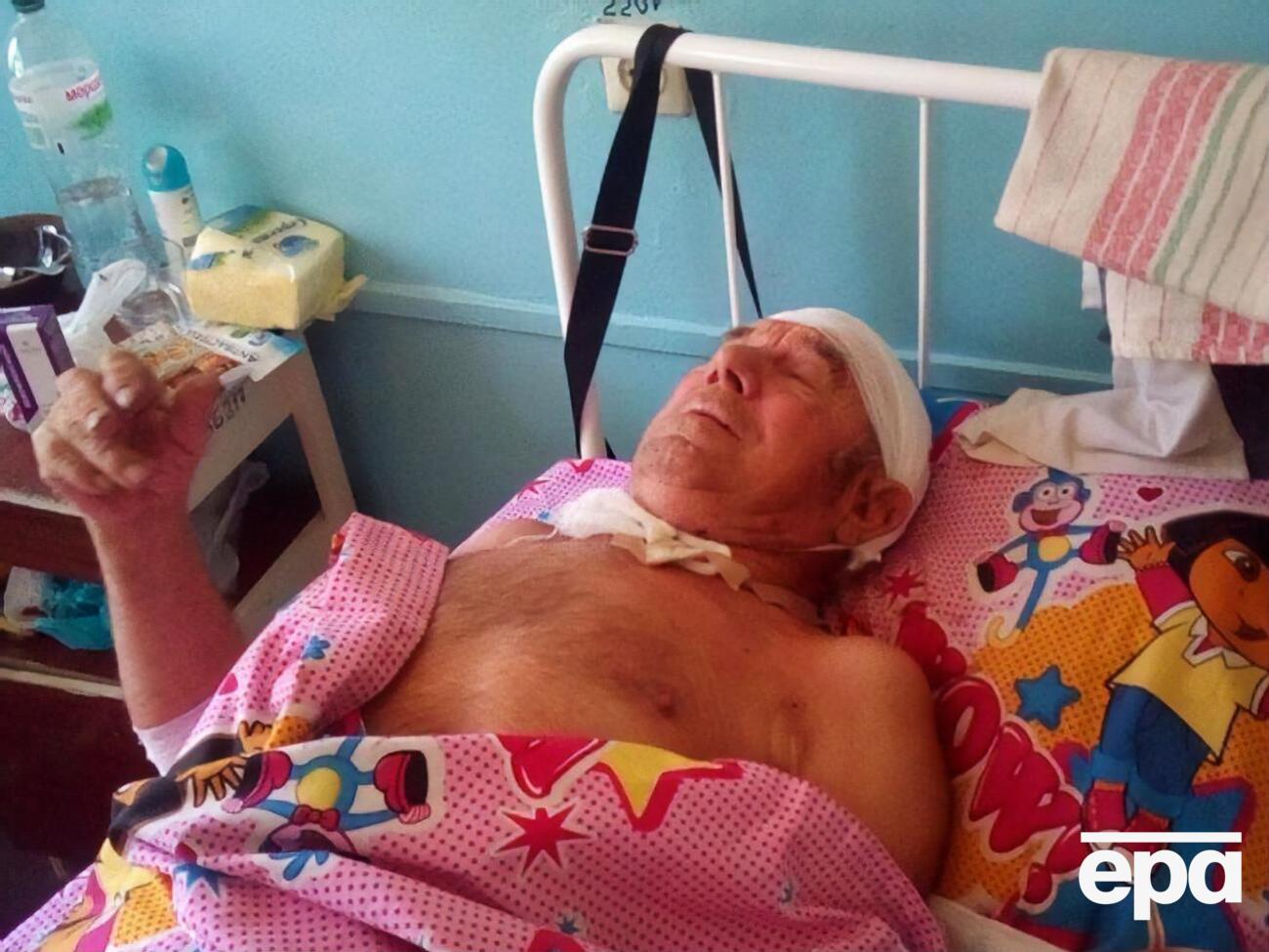 Чоловік перебуває в лікарні
