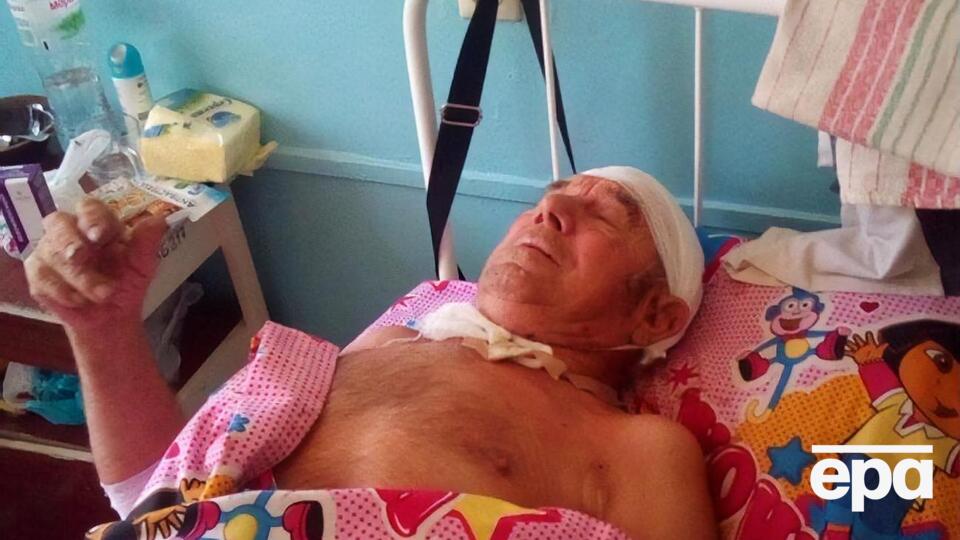 Чоловік перебуває в лікарні