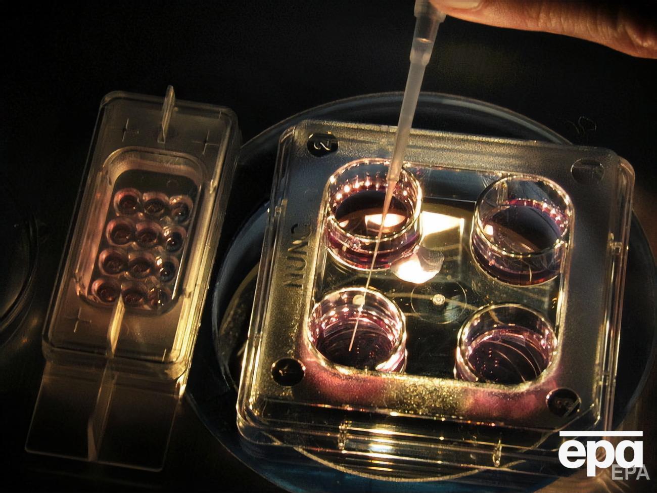 В Индии успешно провели процедуру искусственного оплодотворения 74-летней женщины