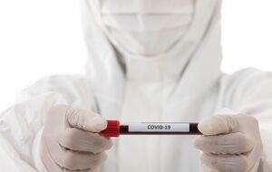 В Україні другий день поспіль фіксують рекордну кількість нових випадків COVID-19