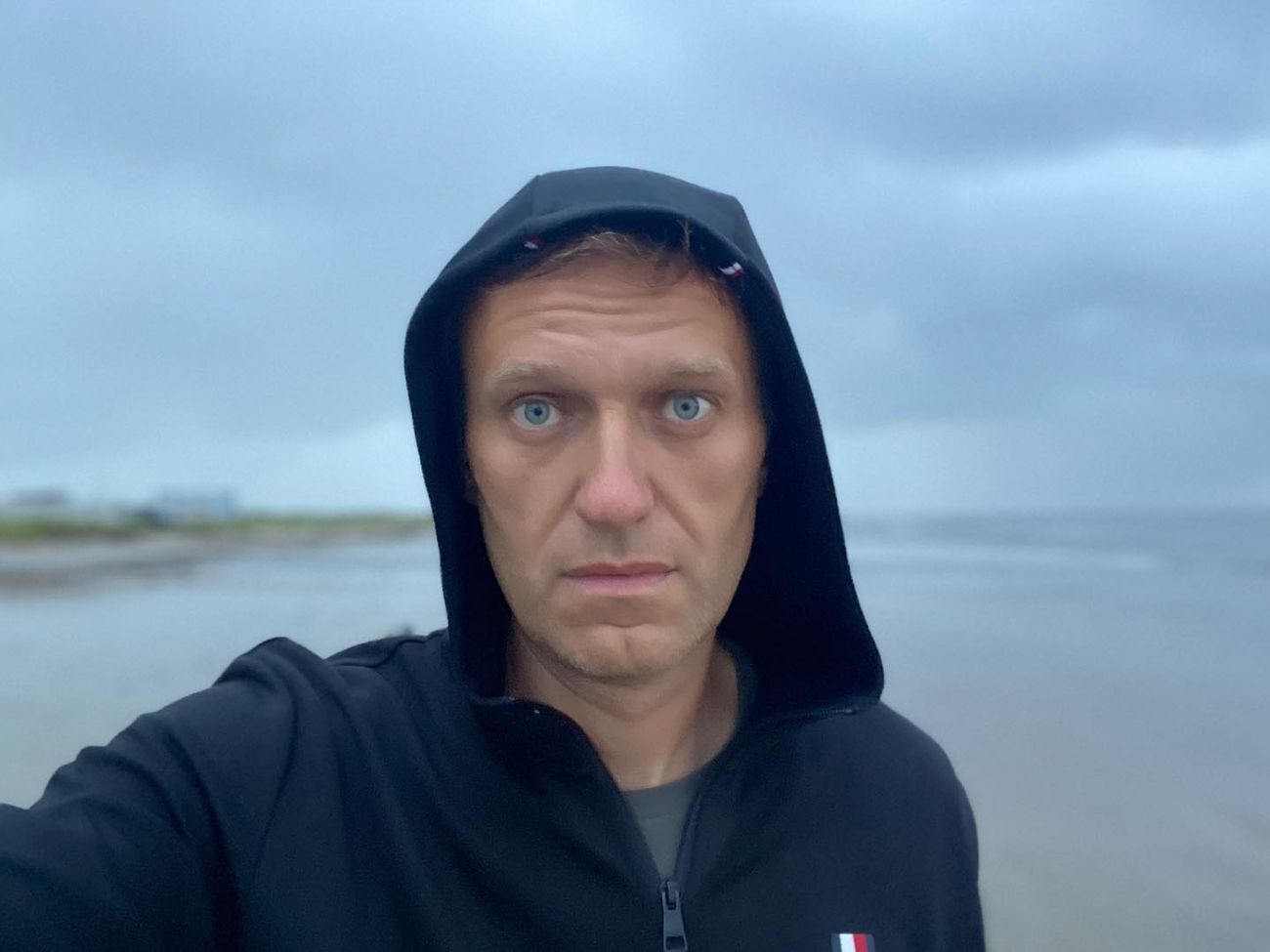 Навальный был в коме 18 дней