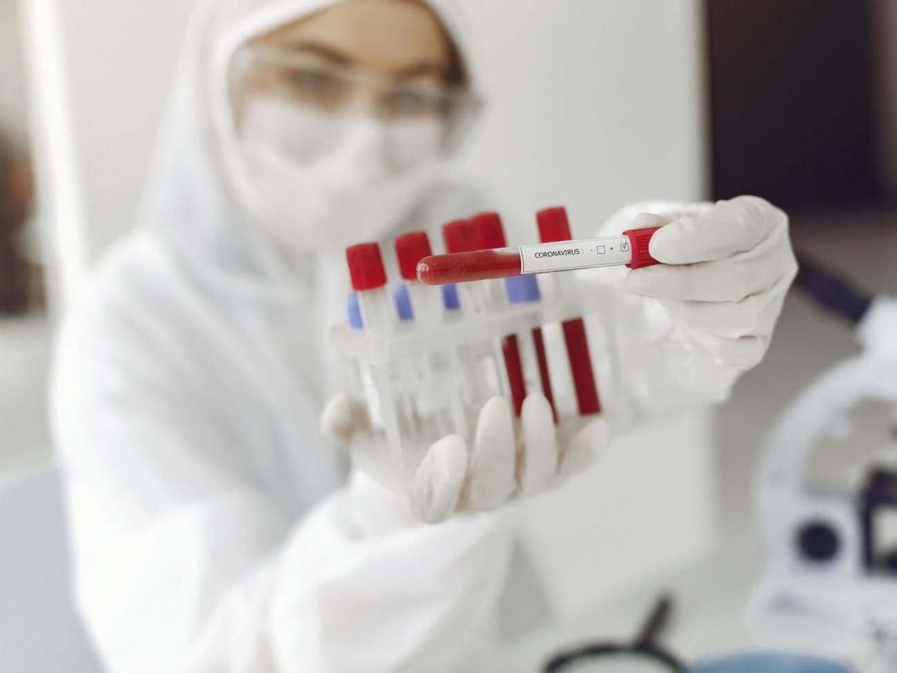 ООН: В ОРДЛО щодня госпіталізують понад 700 пацієнтів із діагнозом "COVID-19"