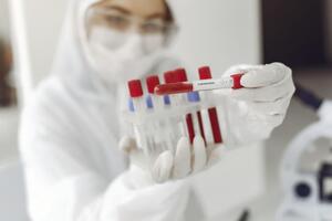 ООН: В ОРДЛО щодня госпіталізують понад 700 пацієнтів із діагнозом "COVID-19"