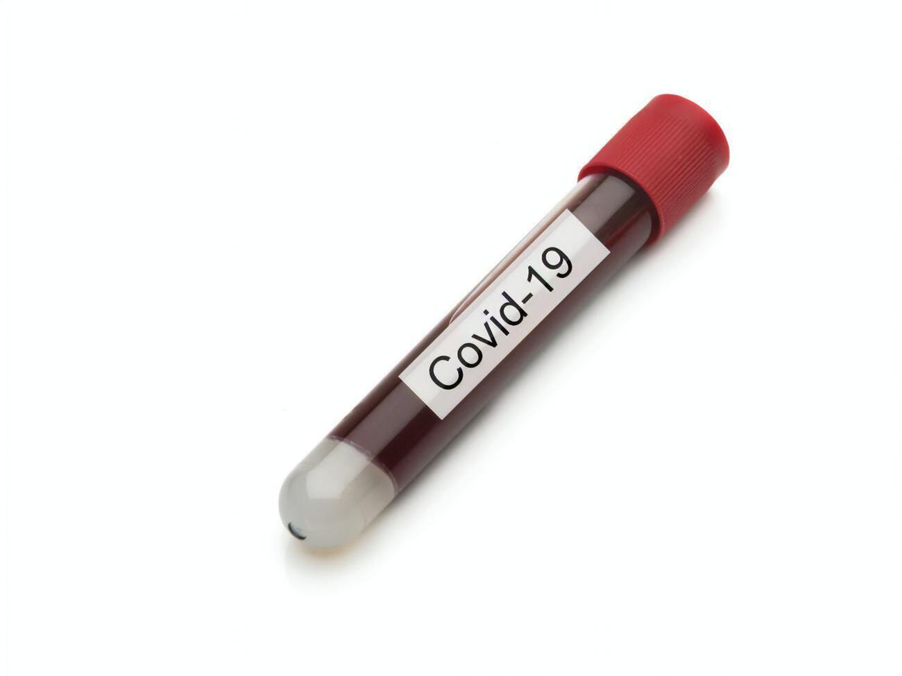 Аксенов: В Крыму от COVID-19&nbsp;выздоровело 3443 человека