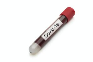 Аксенов: В Крыму от COVID-19 выздоровело 3443 человека