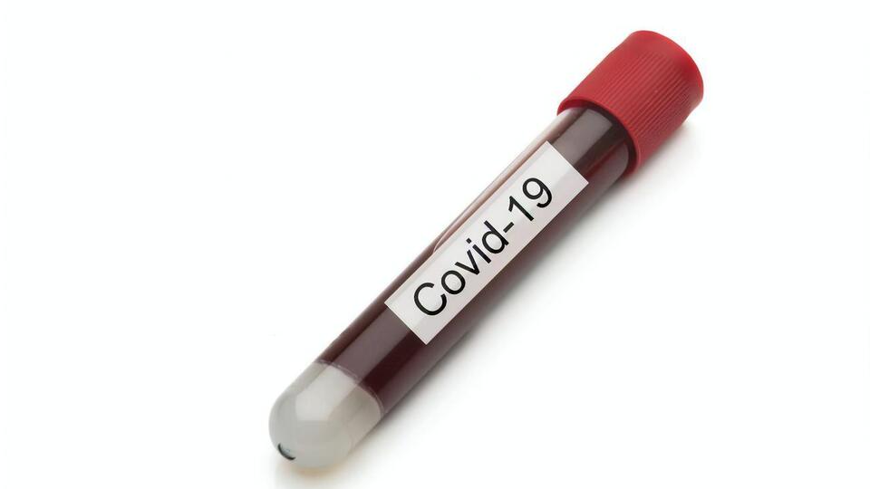 Аксенов: В Крыму от COVID-19 выздоровело 3443 человека