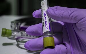 В Украине COVID-19 обнаружили у более чем 77 тыс. пожилых людей