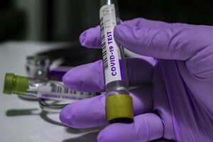 В Украине COVID-19 обнаружили у более чем 77 тыс. пожилых людей