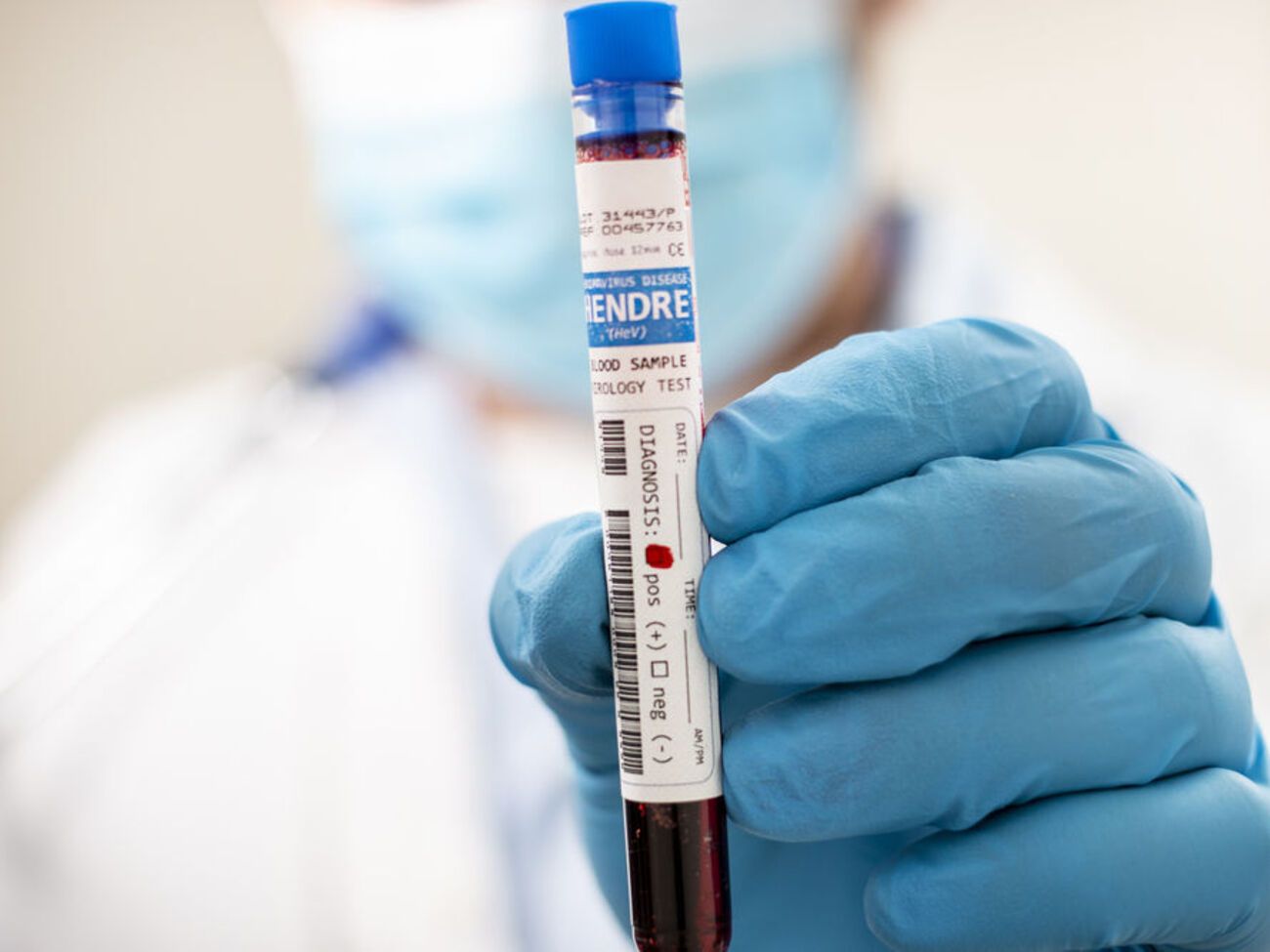 Правозащитники сообщают о 14 тыс. заболевших COVID-19 в ОРДЛО