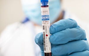 Правозащитники сообщают о 14 тыс. заболевших COVID-19 в ОРДЛО