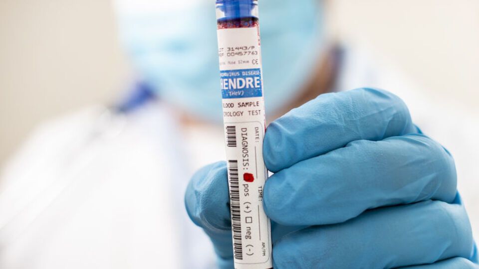 Правозахисники повідомляють про 14 тис. хворих на COVID-19 в ОРДЛО