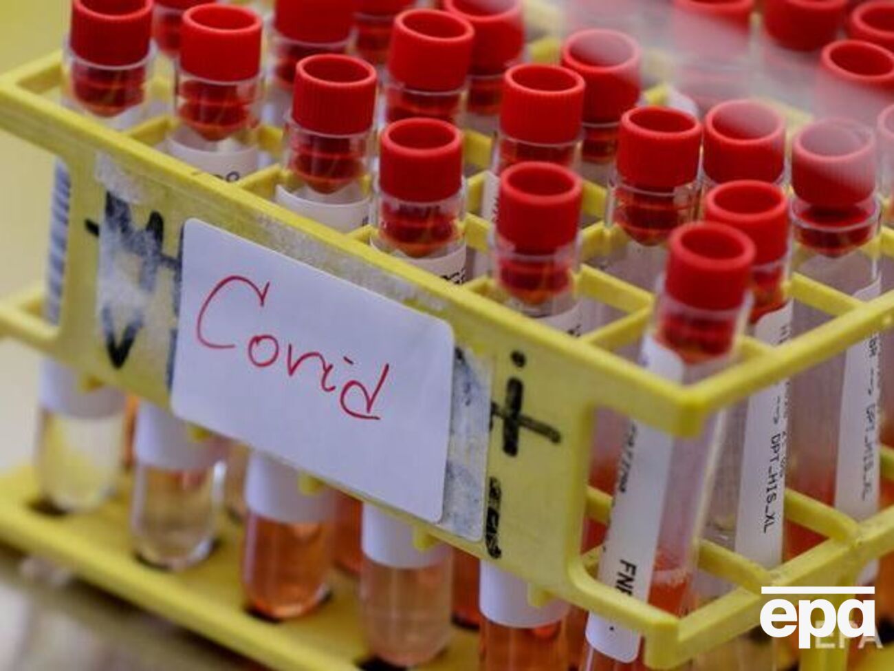 В Украине очередные рекорды по COVID-19