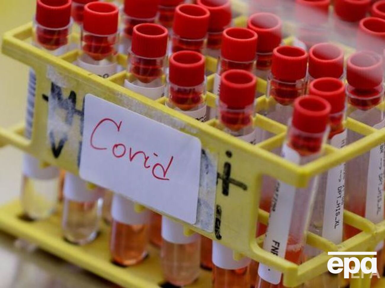 2680 пациентов с COVID-19 выздоровело&nbsp;за сутки в Украине