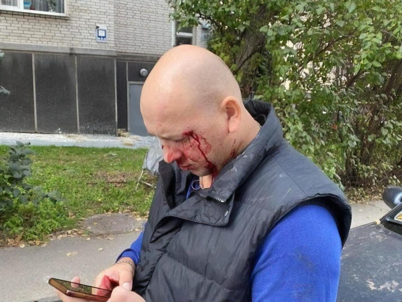 Деева избили 16 октября