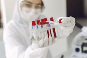 Середня кількість смертей від COVID-19 із 15-го до 21 жовтня в Бельгії протягом доби становила 39 осіб