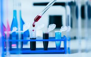 У 11% больных COVID-19 через четыре месяца после выздоровления наблюдалась одышка