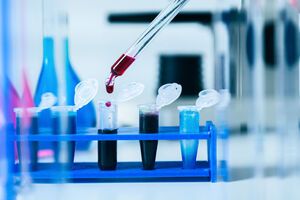 У 11% больных COVID-19 через четыре месяца после выздоровления наблюдалась одышка