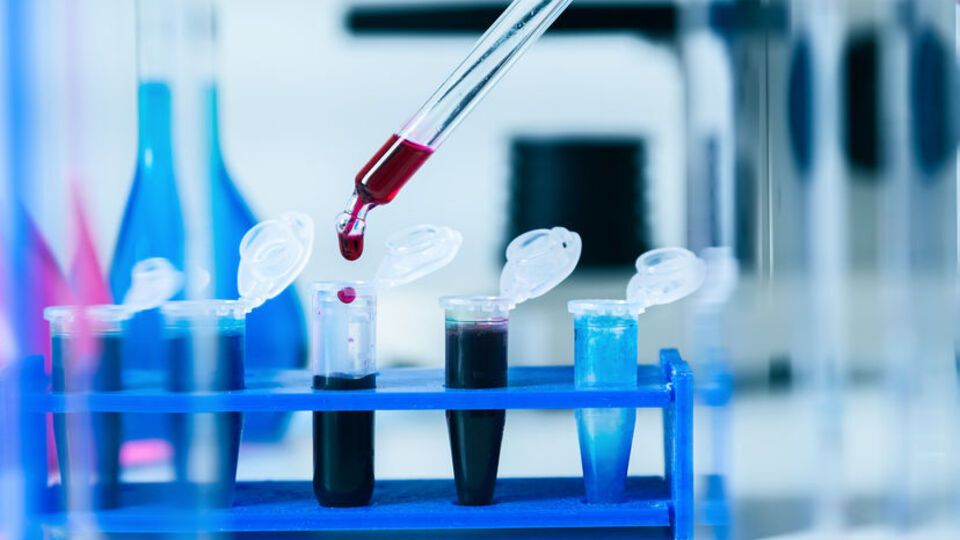 У 11% больных COVID-19 через четыре месяца после выздоровления наблюдалась одышка