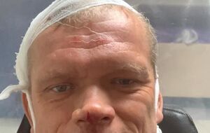 Швайка поехал в больницу скорой и неотложной помощи в Харькове