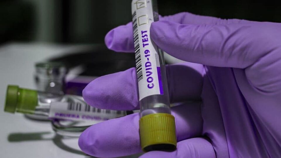 У МОЗ розповіли про статистику тестувань