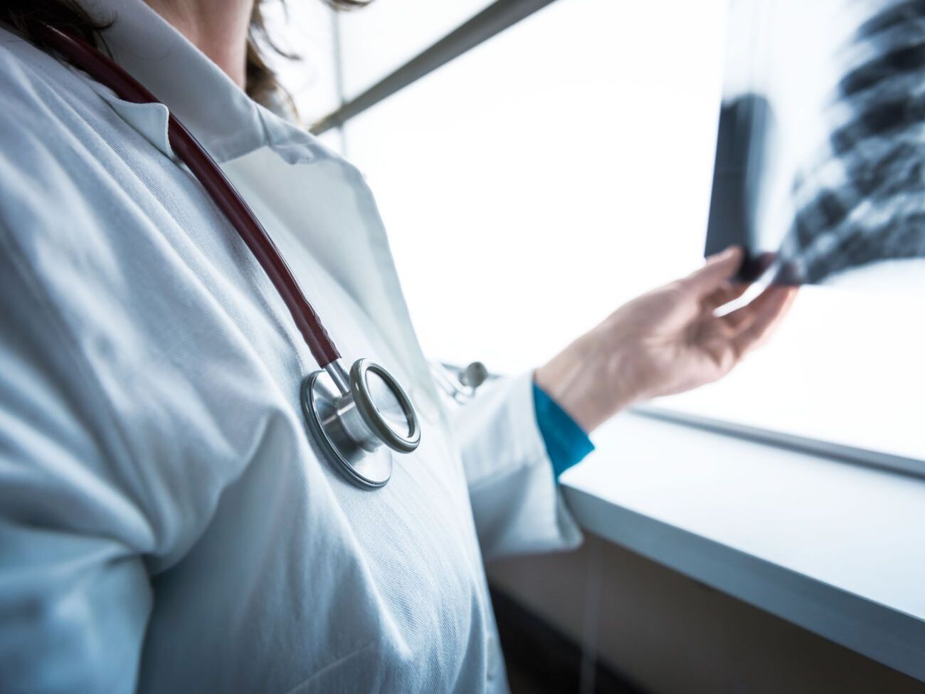 Упродовж останньої доби до лікарень Івано-Франківська із пневмонією доправили 44 хворих