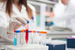 61,5 млн грн із проєкту щодо вдосконалення діагностики онкології Кабмін віддав на ремонт доріг