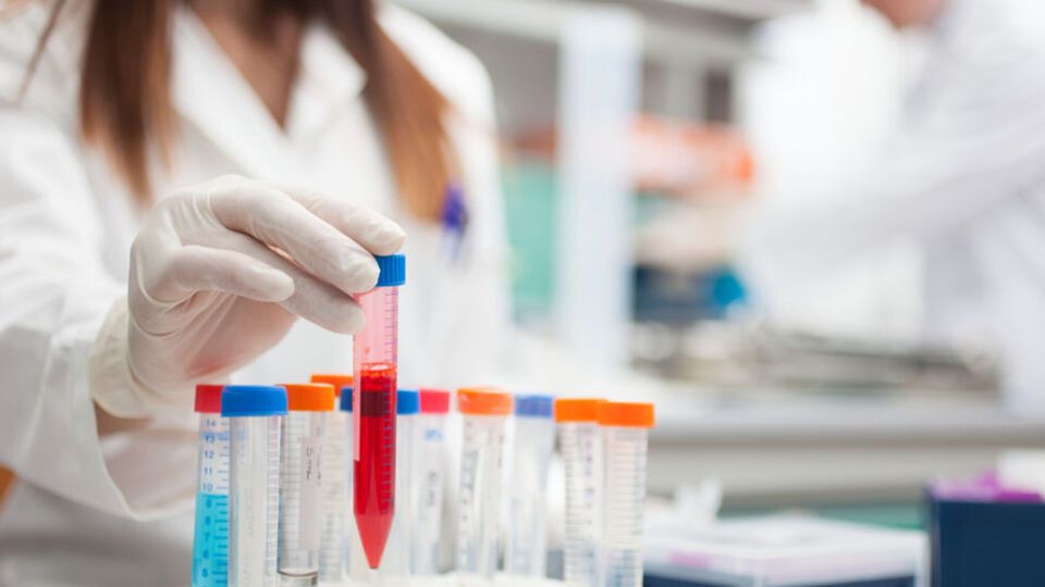 61,5 млн грн із проєкту щодо вдосконалення діагностики онкології Кабмін віддав на ремонт доріг