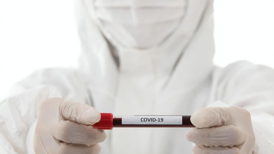 По официальным данным, COVID-19 заболело 35 млн человек
