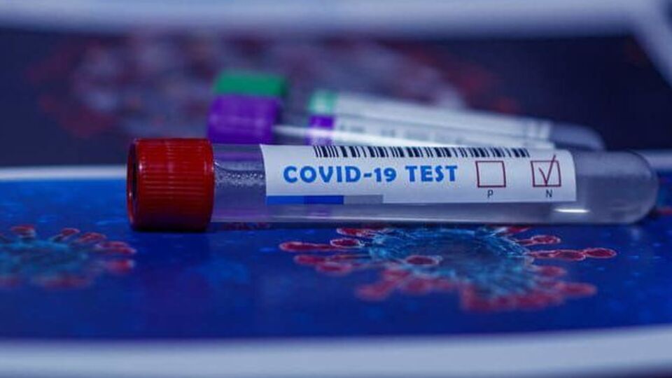 У Полтавській області підтвердили 3270 випадків COVID-19