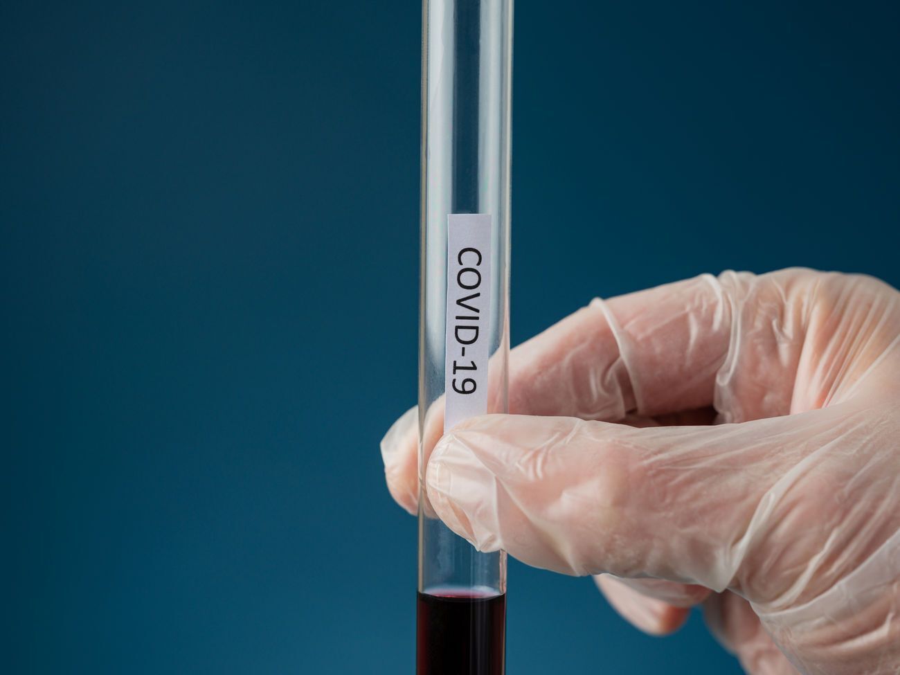 Переболели COVID-19 уже&nbsp;105&nbsp;970 украинцев