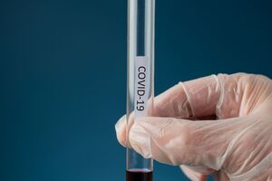 Перехворіло на COVID-19 уже 105 970 українців