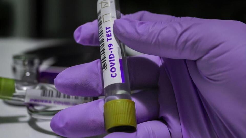 В Минздраве считают недостаточным количество тестирований