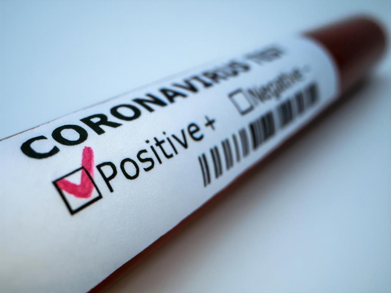 В ОРДЛО 265 осіб померли від COVID-19