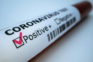 В ОРДЛО 265 осіб померли від COVID-19