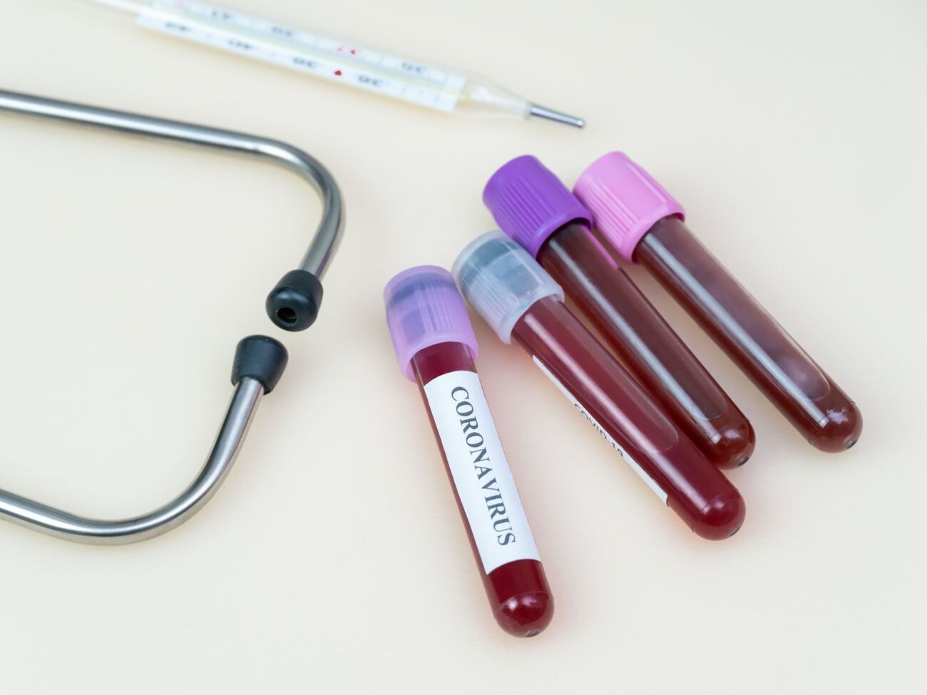 У столиці продовжують активно працювати мобільні бригади медиків, які беруть біоматеріал для аналізу на коронавірус у пацієнтів удома, зазначив мер