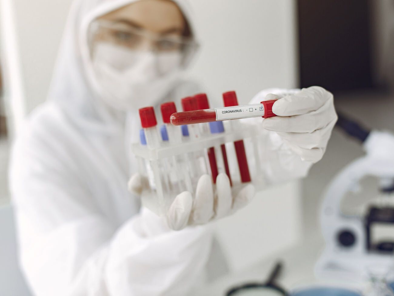 По прогнозам Госпродпотребслужбы, "ряд рекордов" по COVID-19 в Украине будет до марта