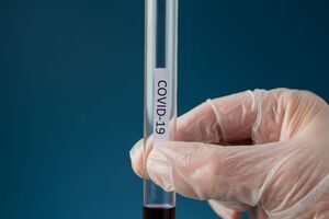 В Украине провели более 2,5 млн тестов на коронавирус