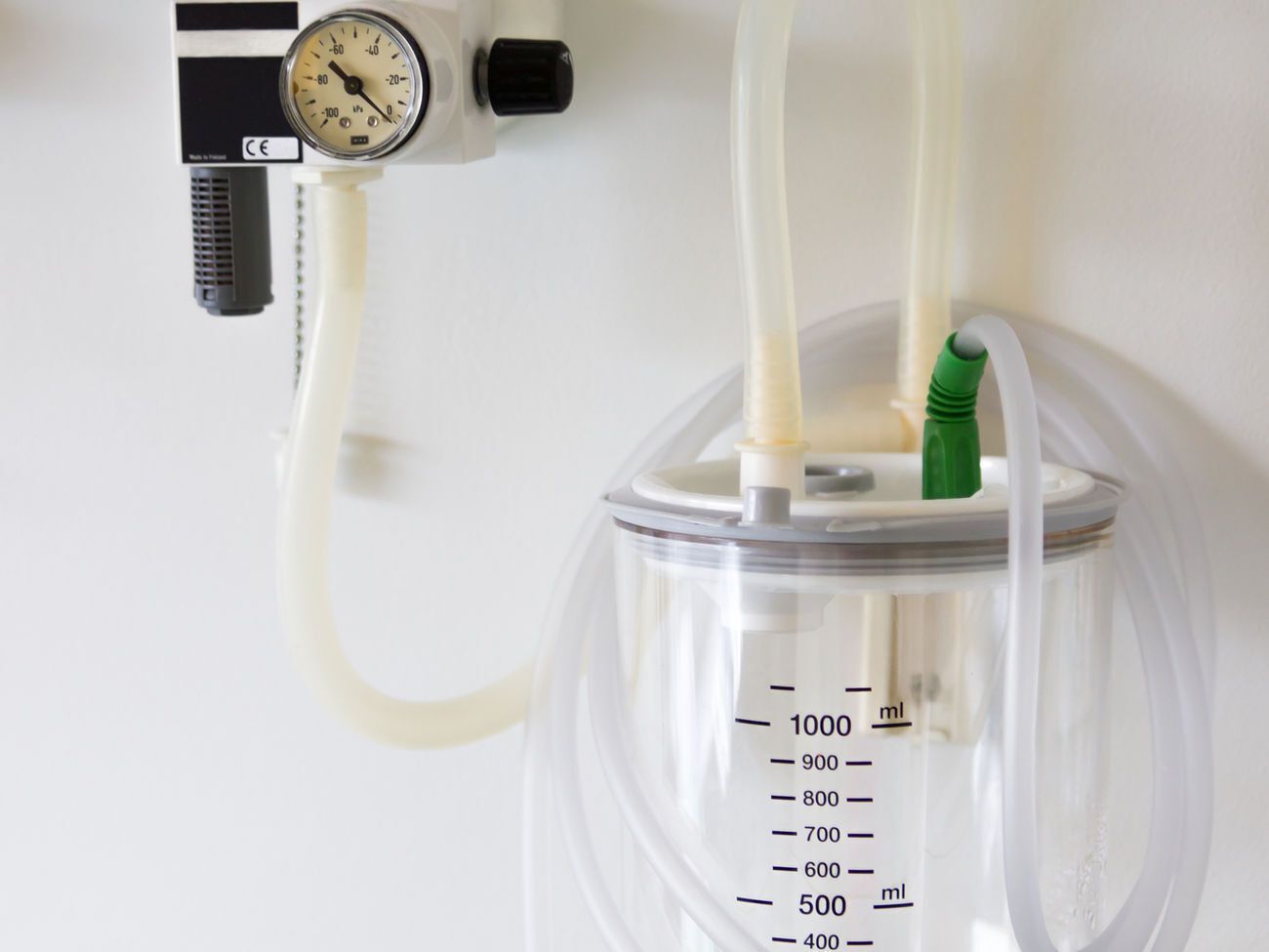 Кисневими системами має бути забезпечено 80% ліжко-місць для хворих на COVID-19, повідомили в Кабміні