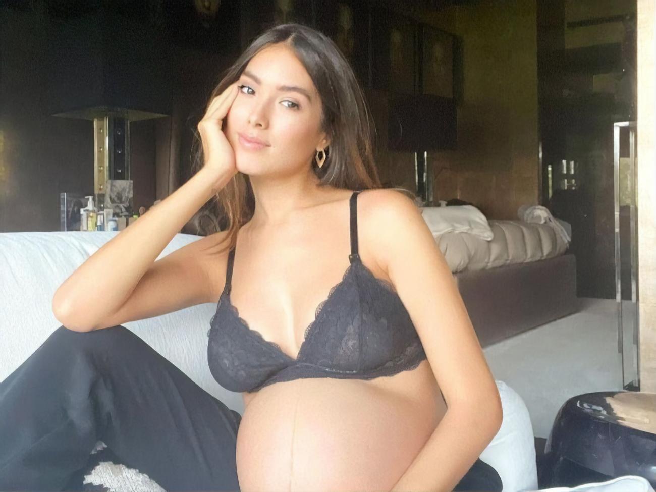 Фонсека:&nbsp;У меня наложены швы от кесарева сечения, а вокруг груди появились растяжки