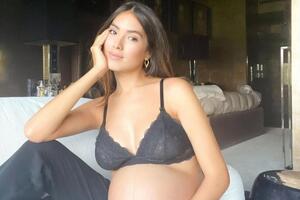 Фонсека: У меня наложены швы от кесарева сечения, а вокруг груди появились растяжки