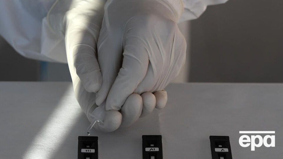 Протягом року у світі підтвердили понад 55,66 млн випадків COVID-19