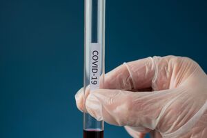 В Україні зафіксовано понад 600 тис. випадків COVID-19