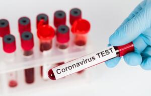 По мнению ученых, быстрые тесты позволят органам здравоохранения применять более целенаправленные меры по предотвращению распространения COVID-19