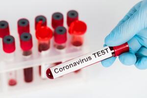 По мнению ученых, быстрые тесты позволят органам здравоохранения применять более целенаправленные меры по предотвращению распространения COVID-19