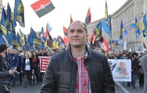 Коронавірус небезпечний ураженням легень, і це може призвести до розвитку інших проблем зі здоров'ям, про які ви раніше й не підозрювали