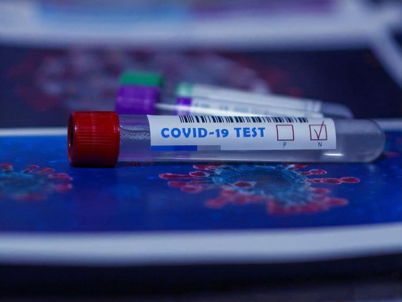 За сутки в Украине провели почти 61 тыс. тестирований на коронавирус