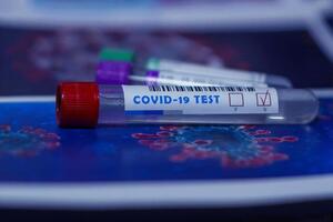 Протягом доби в Україні провели майже 61 тис. тестувань на коронавірус